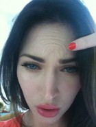 Megan Fox botox